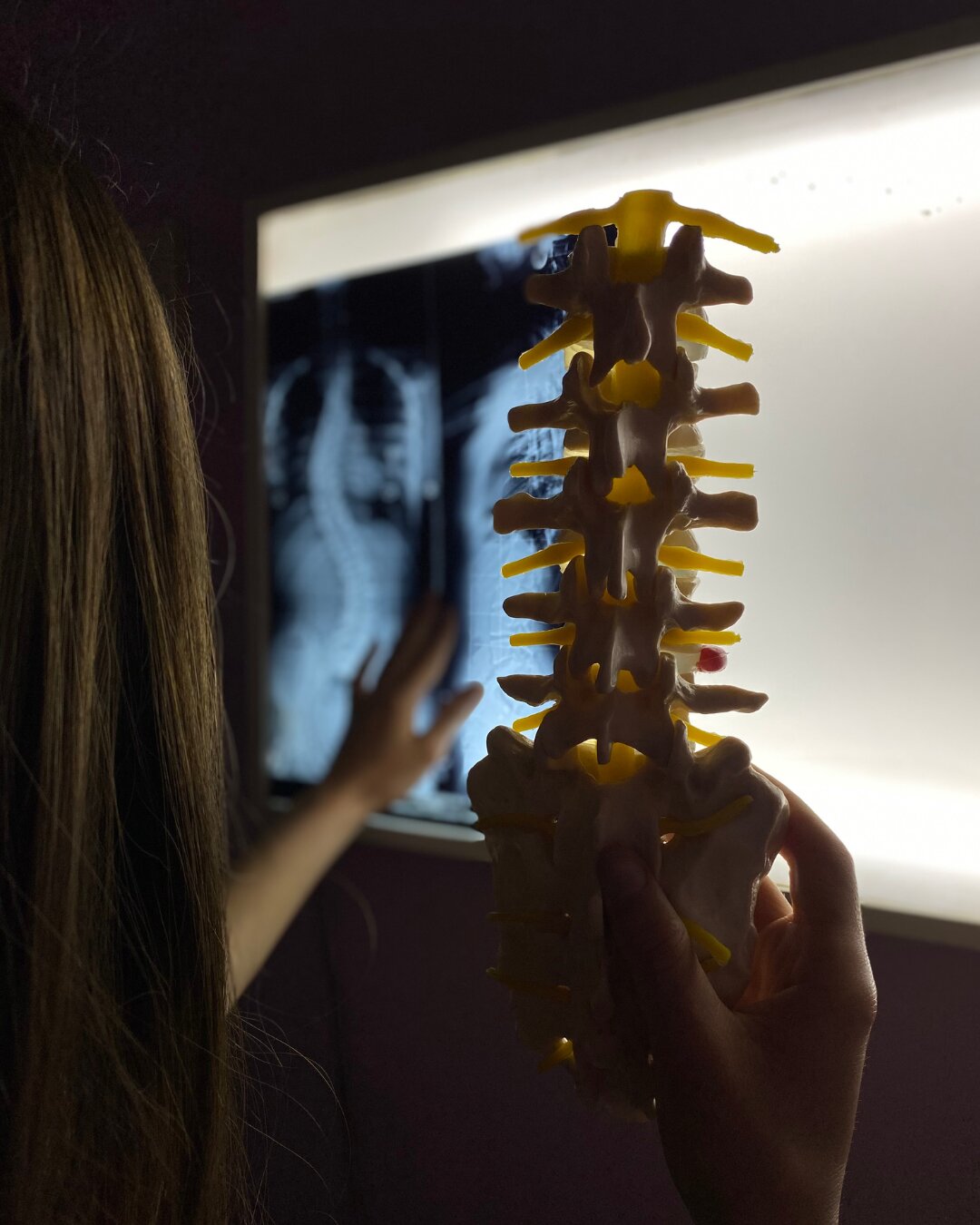 Analiză radiografie coloană