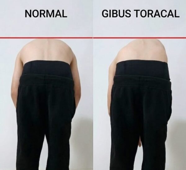 Testul Adams