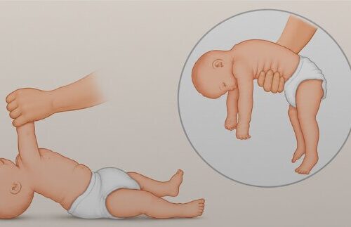 Hipotonia Musculară Hipotonia Musculară