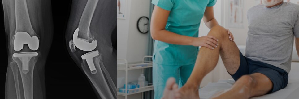 Recuperare după proteză totală de genunchi (artroplastie totală de genunchi)