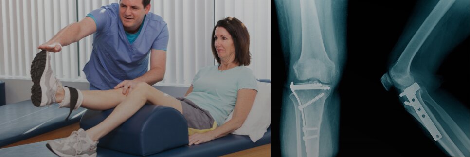 Recuperare după fracturi operate (tije, plăci, șuruburi șI alte sisteme de osteosinteză)