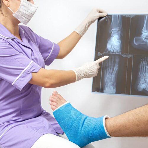 bone-fracture-foot-leg-male-patient-being-examined-by-woman-doctor-hospital bone-fracture-foot-leg-male-patient-being-examined-by-woman-doctor-hospital