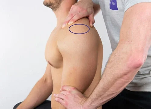 shoulderassessment_sulcussign-640x361 shoulderassessment_sulcussign-640x361
